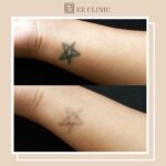 EE CLINIC (SRI PETALING)34