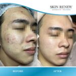 Skin Renew Aesthetics & Wellness2
