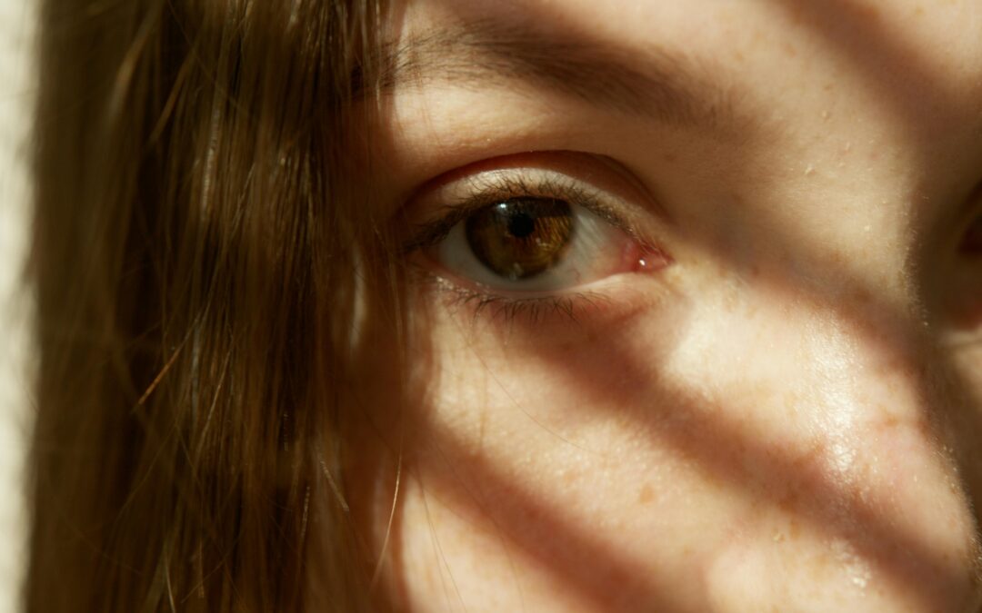 Diagnosing Dark Circles