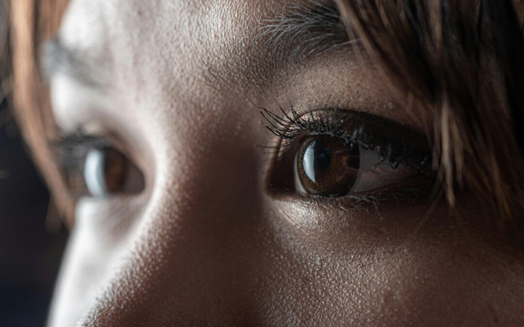 Medical Treatments For Dark Circles Under Eyes