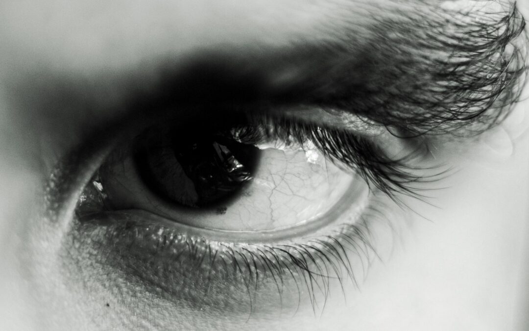 Are Dark Under-Eye Circles Permanent?