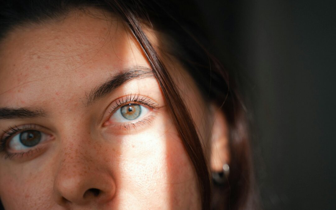 What Causes Dark Circles Under The Eyes?