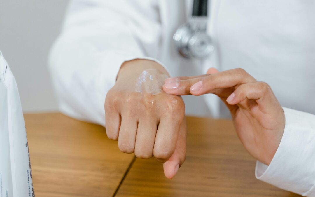 What Is Eczema?