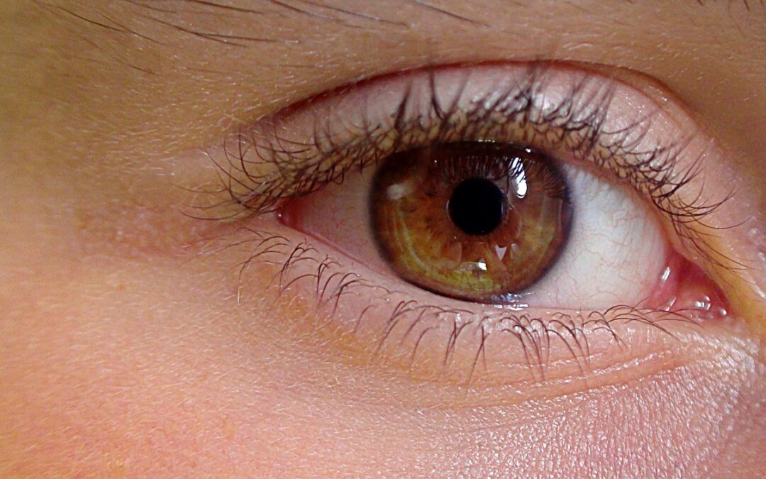 How To Get Rid Of Bags Under Eyes?