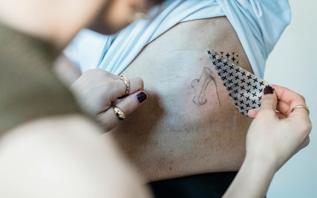 Who Is A Candidate For Tattoo Removal?