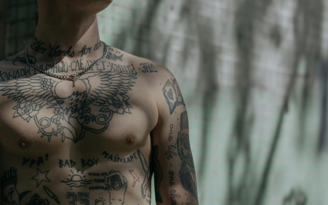 What Is The Process Of A Laser Tattoo Removal Procedure?