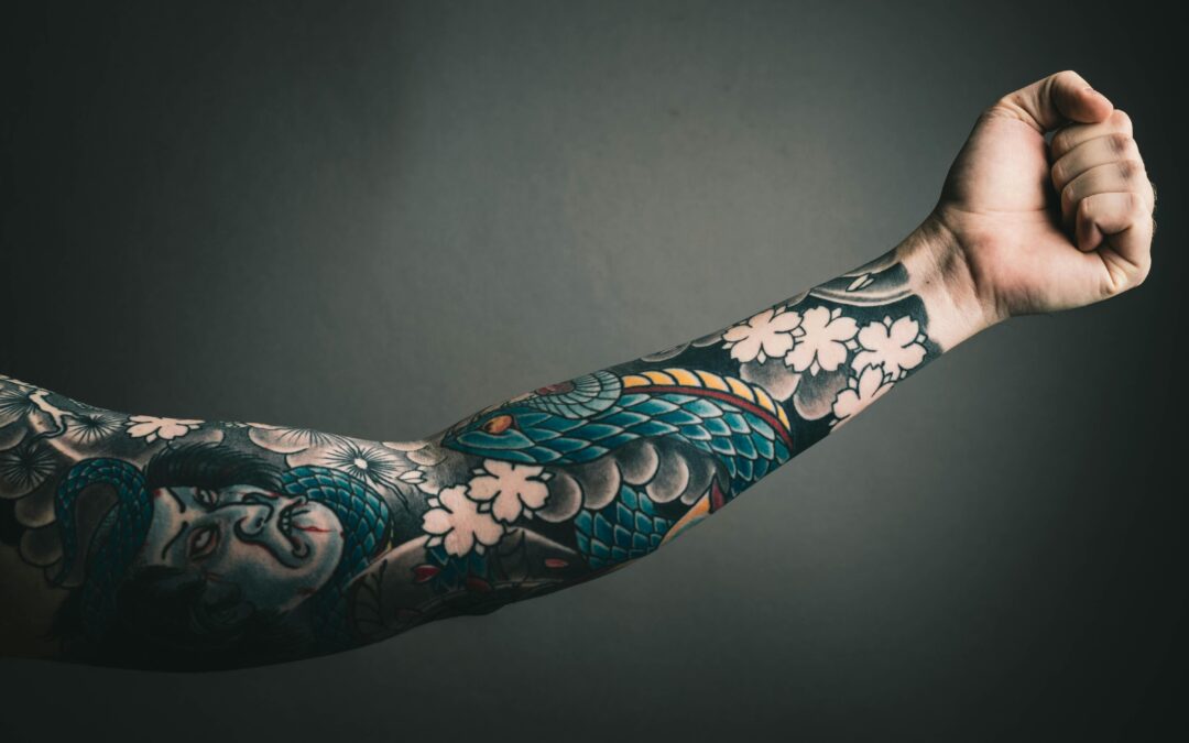 Is Tattoo Removal Safe?