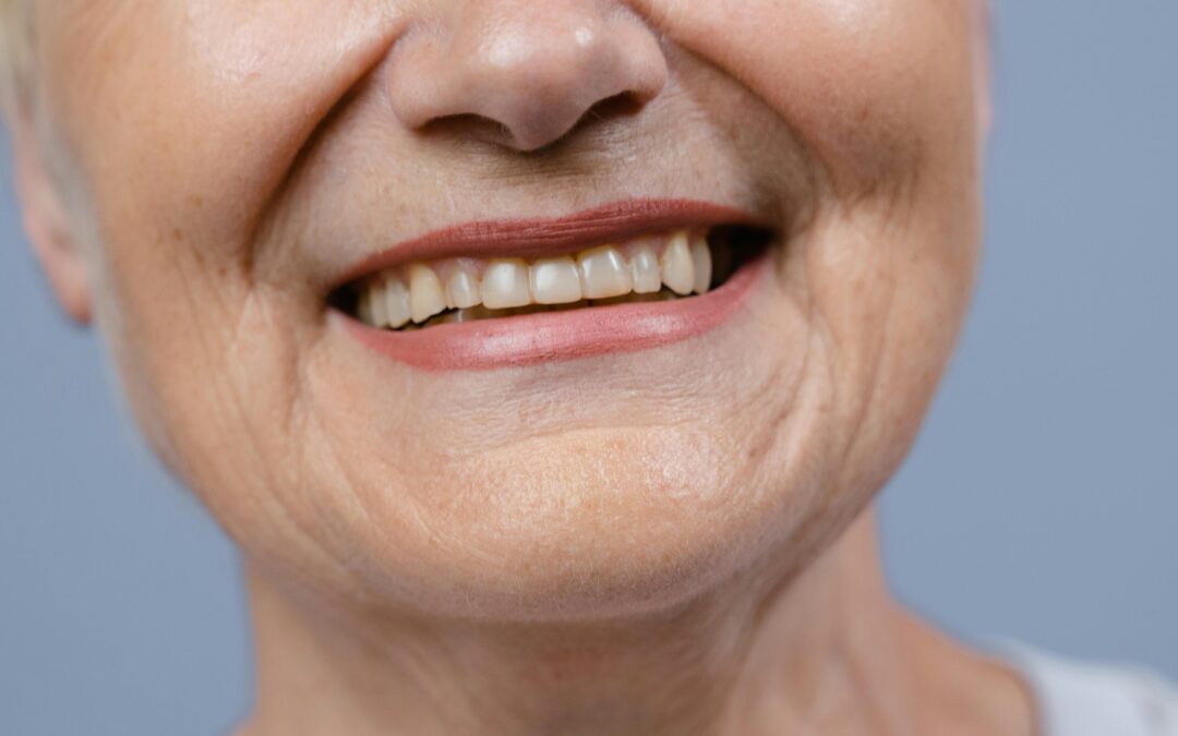 All You Need To Know About Wrinkle Treatment