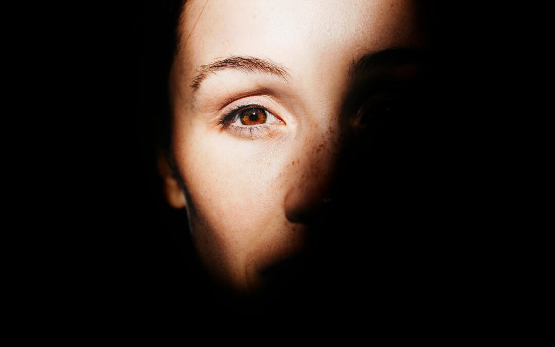 Best Solution For Dark Circle Under Eyes In Singapore