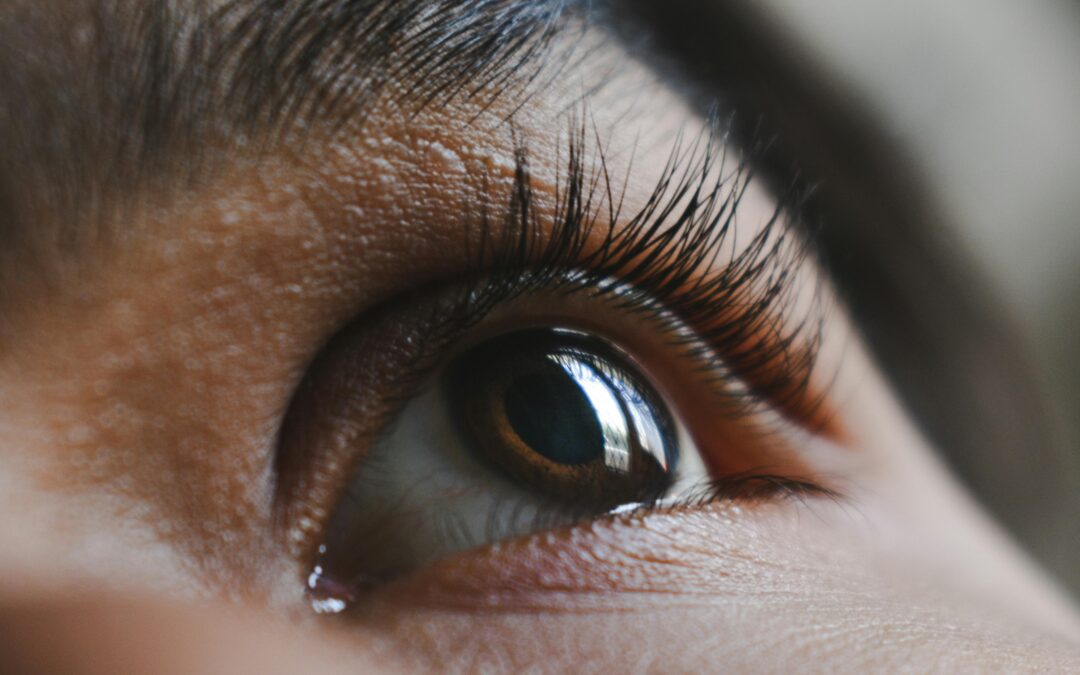 How Do Dermatologists Treat Dark Circles Under The Eyes In Singapore?