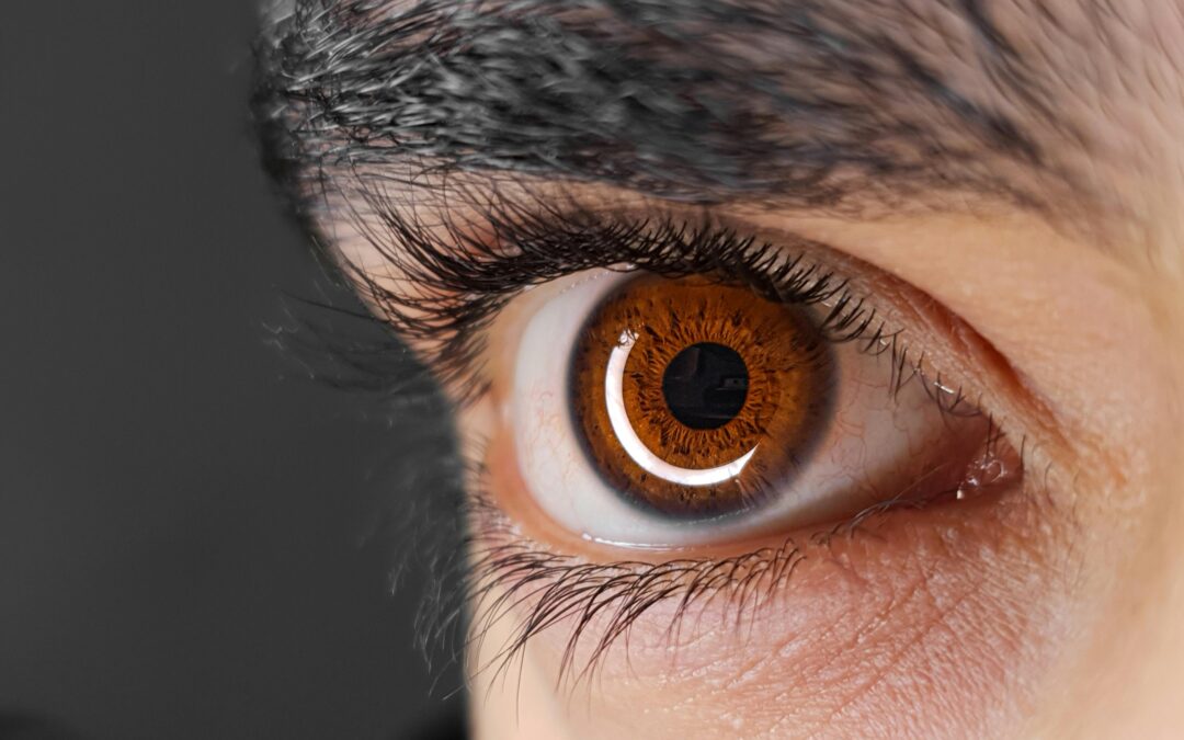 Most Popular Treatment For Dark Circle Under Eyes In Singapore