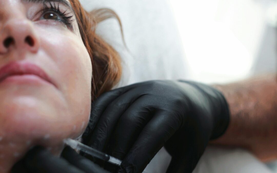 What Are Dermal Fillers?
