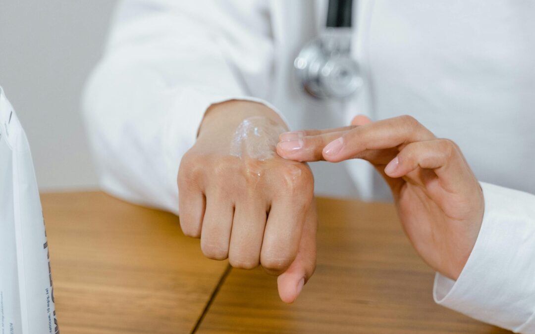 How To Get Rid Of Eczema?