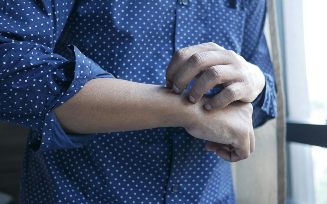 Everything You Need To Know About Eczema Treatment Procedure In Singapore