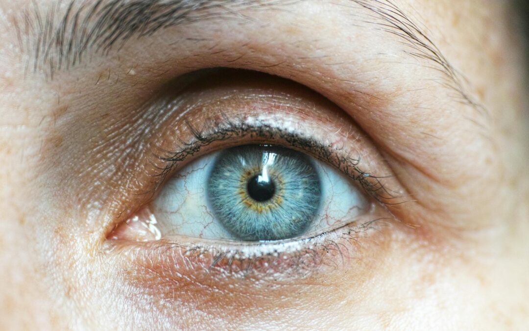 Everything You Need To Know About Eyebag Removal In Singapore