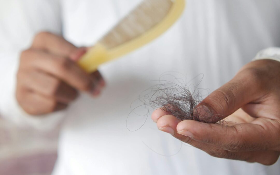 Non Surgical Hair Loss Treatment In Singapore