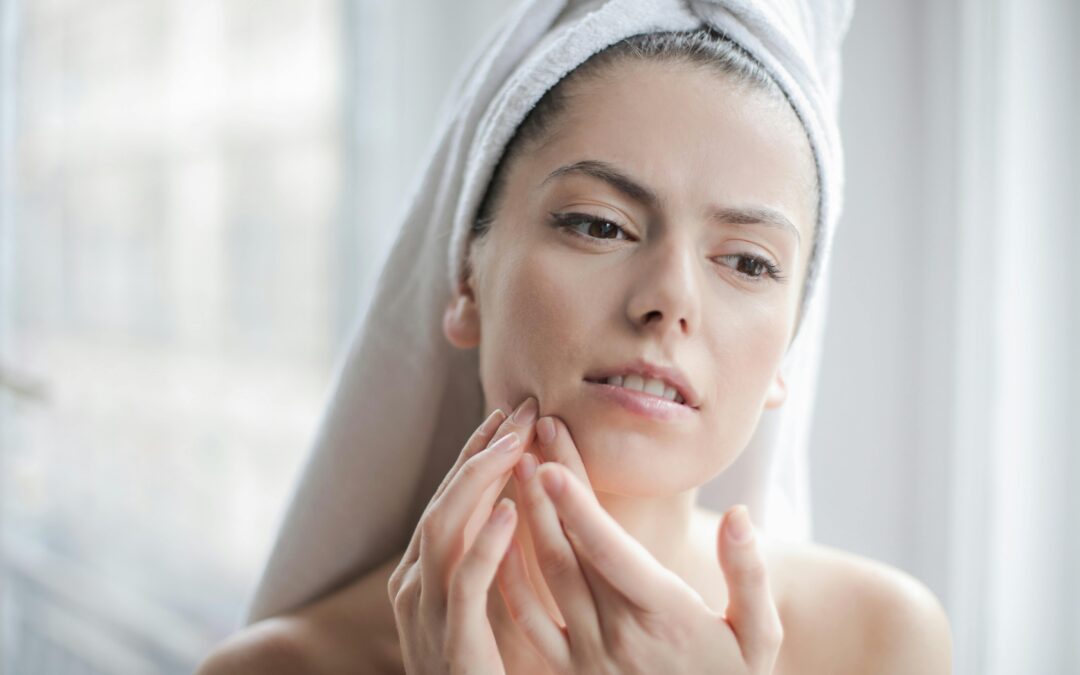 Everything You Need To Know About Milia Removal In Singapore